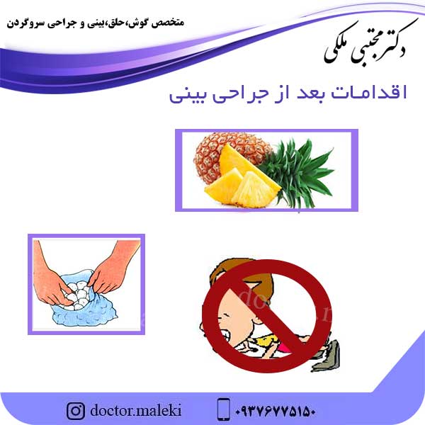 مراقبت های بعد از جراحی بینی
