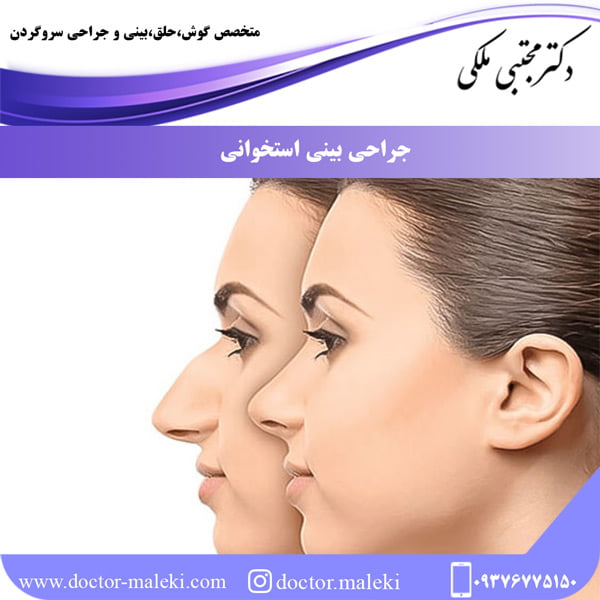 جراحی بینی استخوانی